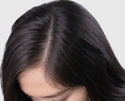 Healthy Scalp
